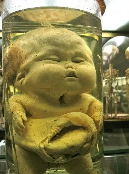 胆大者的旅行 带你走进10座最吓人博物馆