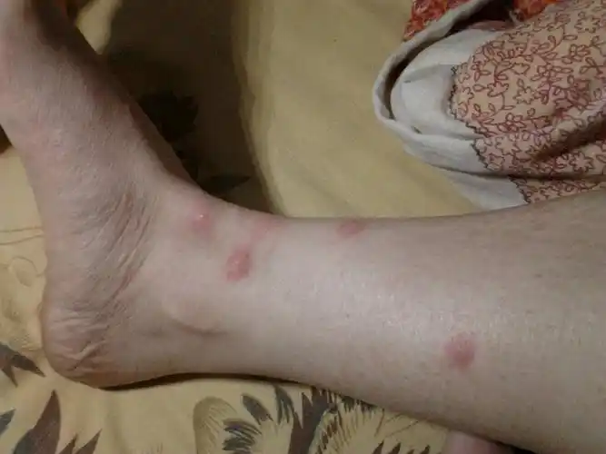 用什么药好拉,有个医生开咯点儿皮肤病血毒片