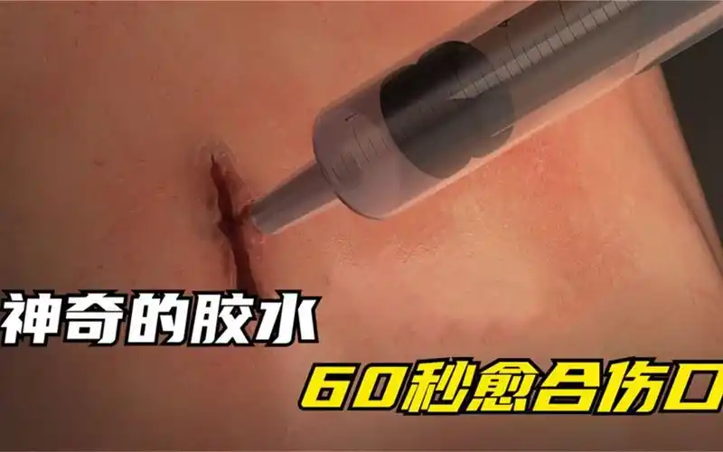 不可思议的医用胶水,只需60秒就能粘住伤口,外内伤都能用
