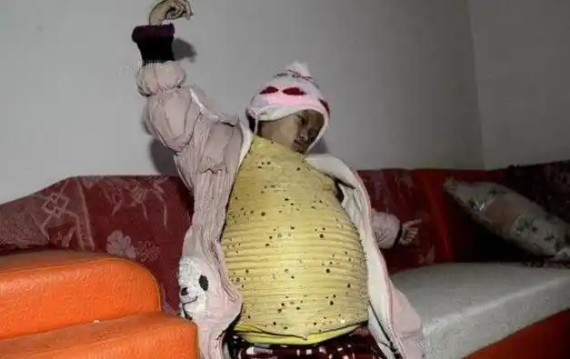 岁的小女孩,对她的第一印象,你很可能会只注意到她那像怀孕十月的肚子