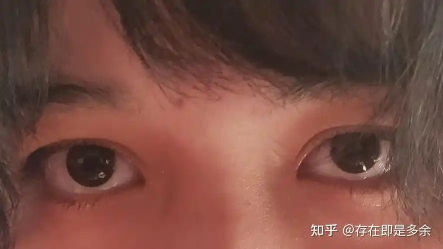 抑郁的人眼神都很空洞吗