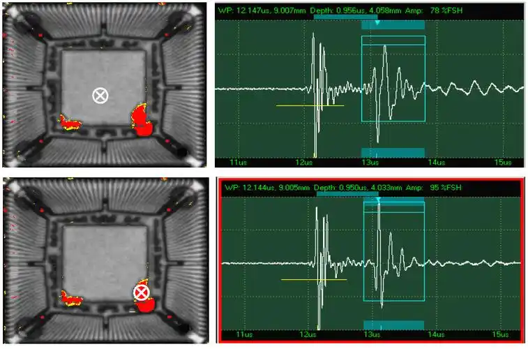 教你如何看懂超声波图片