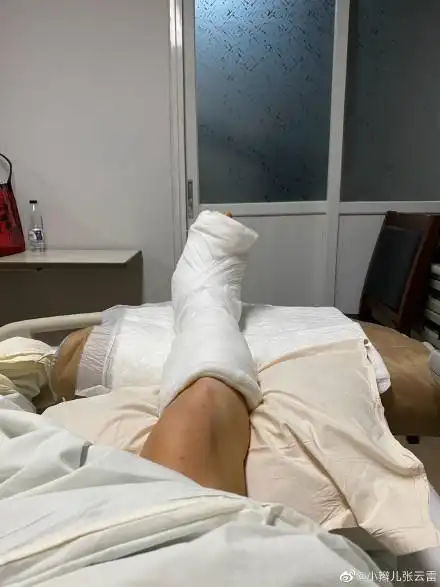 张云雷小腿裹满纱布报平安:手术很顺利放心