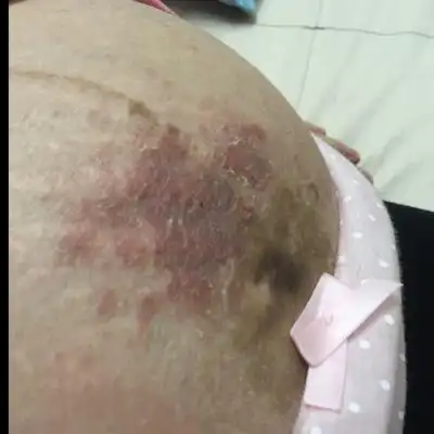 该怎麼办?(有图,可能会引起其她妈妈的不安)