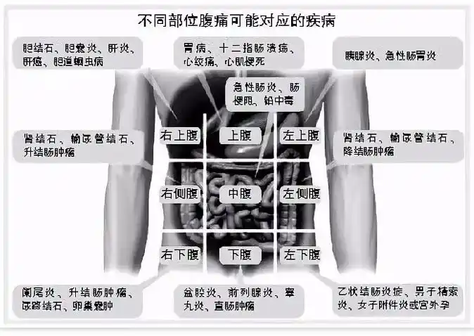 肚子疼,到底是哪里出了问题?一张图帮你初步判断,找对科室!