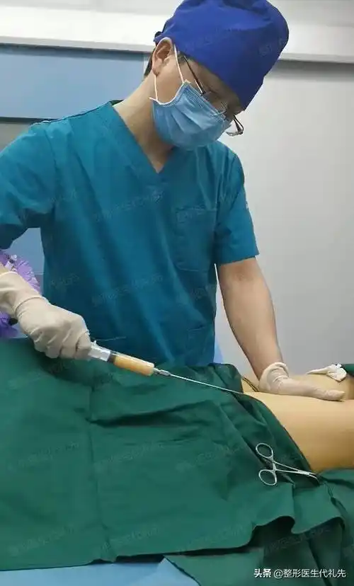 聊一聊抽脂有什么风险和后遗症