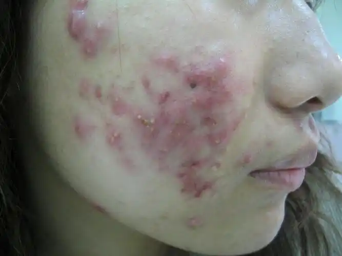 医学美容新知与新闻