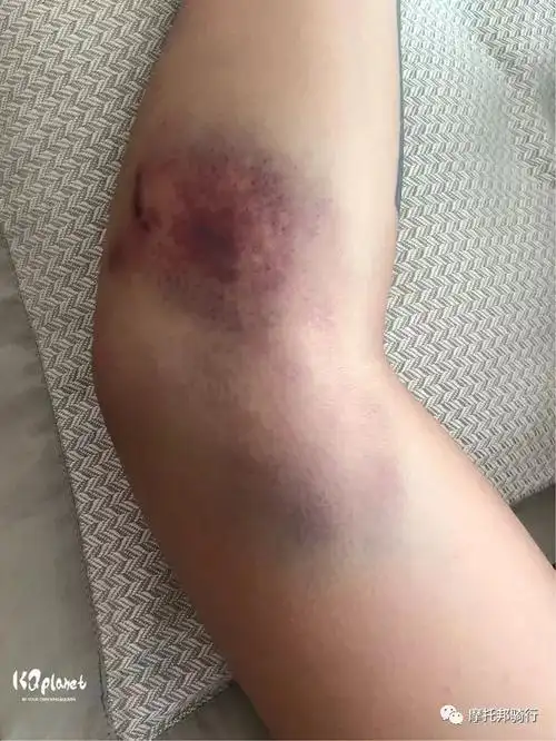 目前为止摔的最惨玩的最high的越野记录来自摩托邦用户kq一planet文正