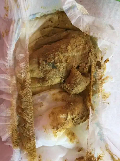 宝宝拉粑粑为什么先拉稀的之后是干的.这是怎么回事