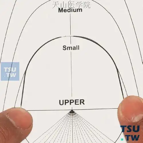 meaw弓丝的弯制:前牙段形成弓形