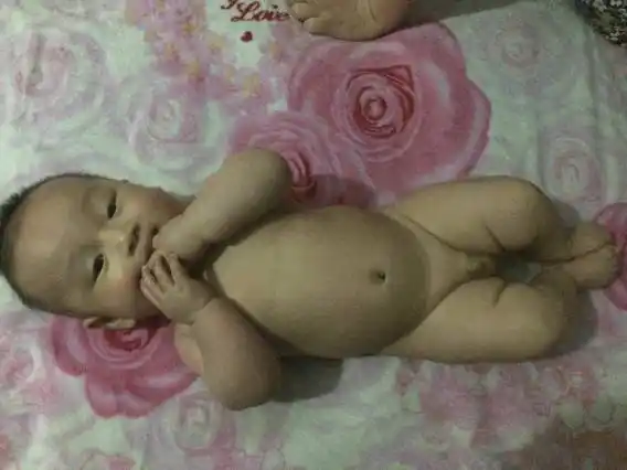 男宝的小鸡鸡长这样该怎么办?这是什么情况