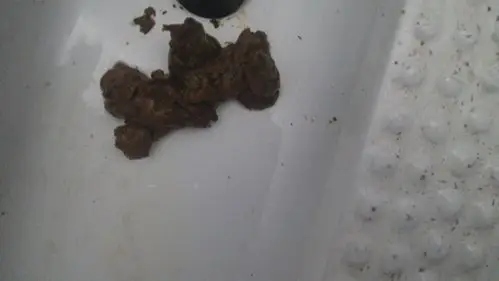 今天上厕所不知道是不是拉出了柏油样便上完厕所卫生纸上是红色