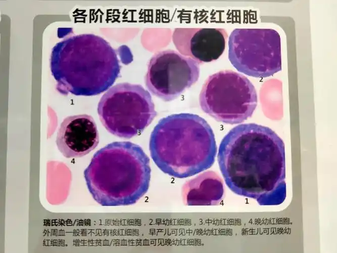 医学检验医学检验技术医学显微镜血液细胞