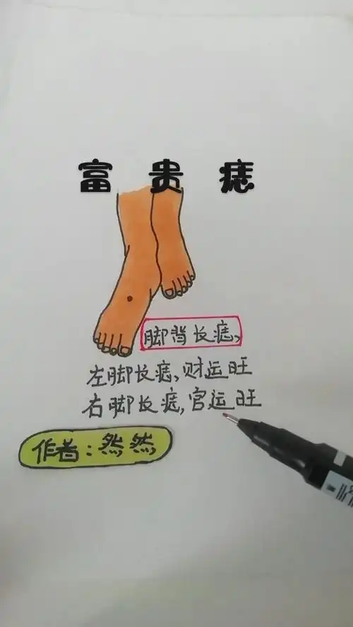 脱鞋看看你的脚背有痣吗