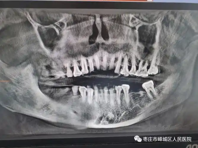 您知道吗口腔也可以做ct哦