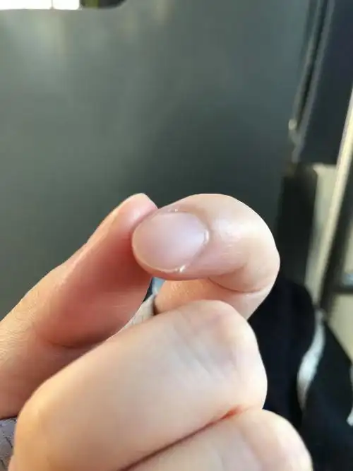 指甲老是侧边开裂,像毛刺一样,怎么回事啊