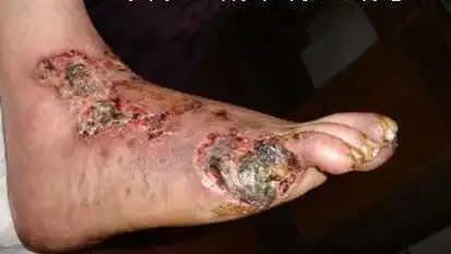 王氏经络免疫疗法创始人第九代传人王海波