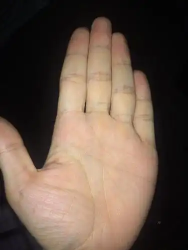 断掌是什么样的图片 断掌是什么样子的图片