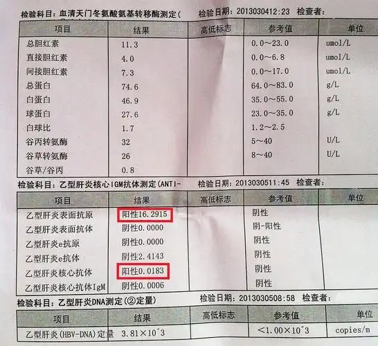 ">hbv-dna /a>定量是 a target="_blank" href="/item/乙肝/202614"
