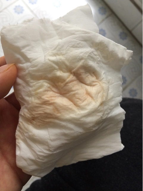 孕38周,我这是见红了吗?(有图慎入)