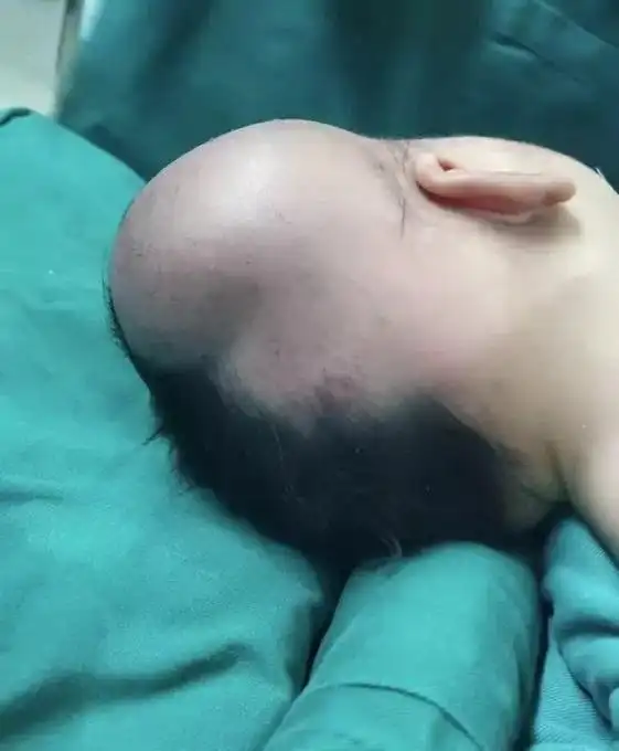 二孩孕妈正散步 5分钟后