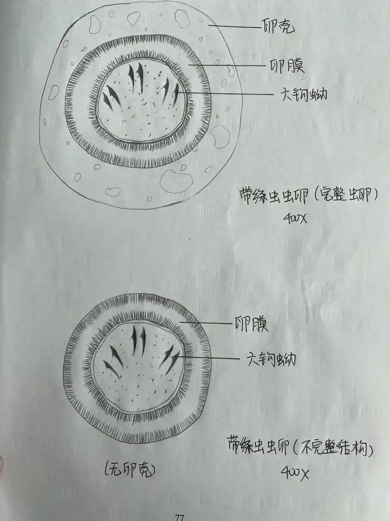 带绦虫虫卵手绘图      这次感觉画的不像,大家随便看看就行