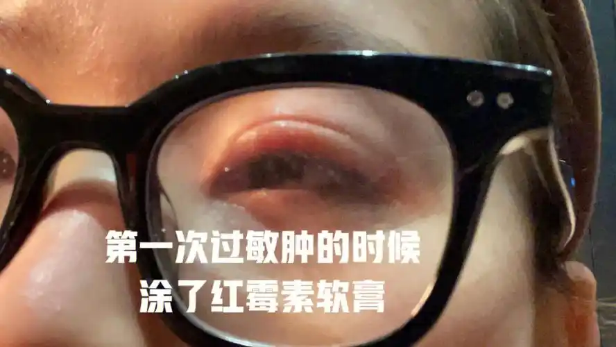 就选了一家价格中等的附近的店当时做的时候我发现有点痒有点熏眼睛没