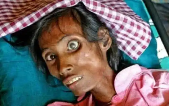 致死3300万人后,艾滋病零号病人终于找到?答案出乎意料