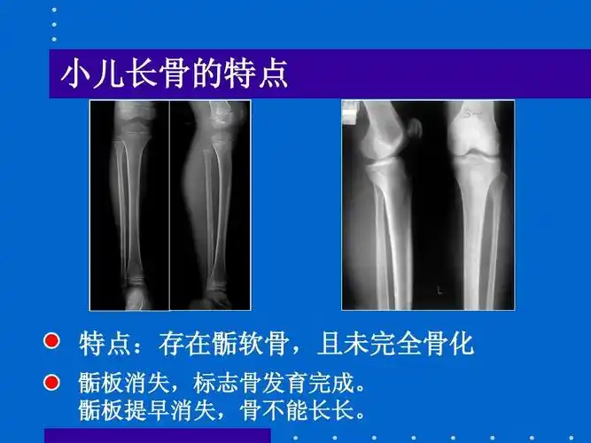 骺板提早消失,骨不能长长.