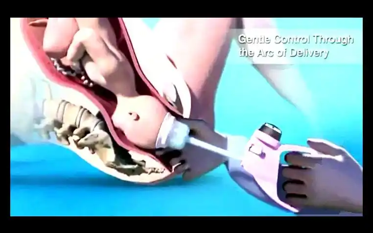 3d动画诠释女人顺产分娩全过程妈妈真是伟大