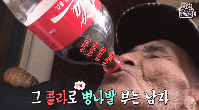 一个把可乐当水喝的人,他的牙会是什么样子?让我们一起来看看