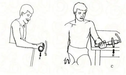 网球肘的自我康复锻炼
