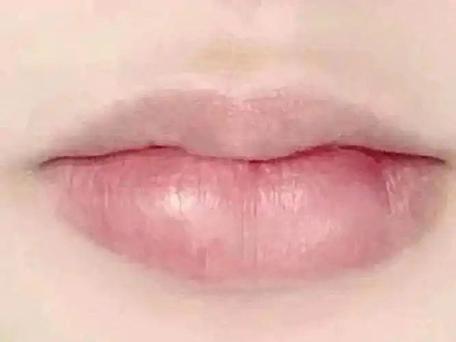 我对自己的唇型十分不满意,上唇很薄下唇又很厚,特别_圈子-新氧美容