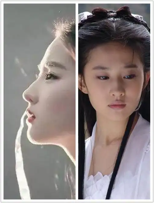 驼峰鼻和鹰钩鼻很好区分啦,无论_圈子-新氧美容整形