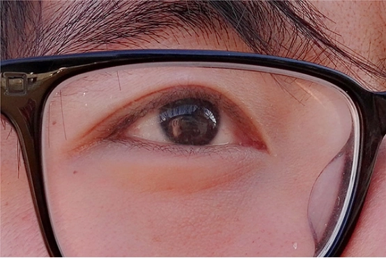 近视是现代人常见的一种眼睛问题,有近视的人在看东西的时候,离得远