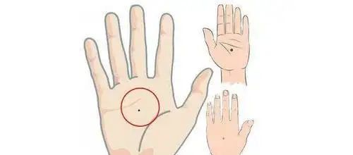 左手背长痣是什么意思