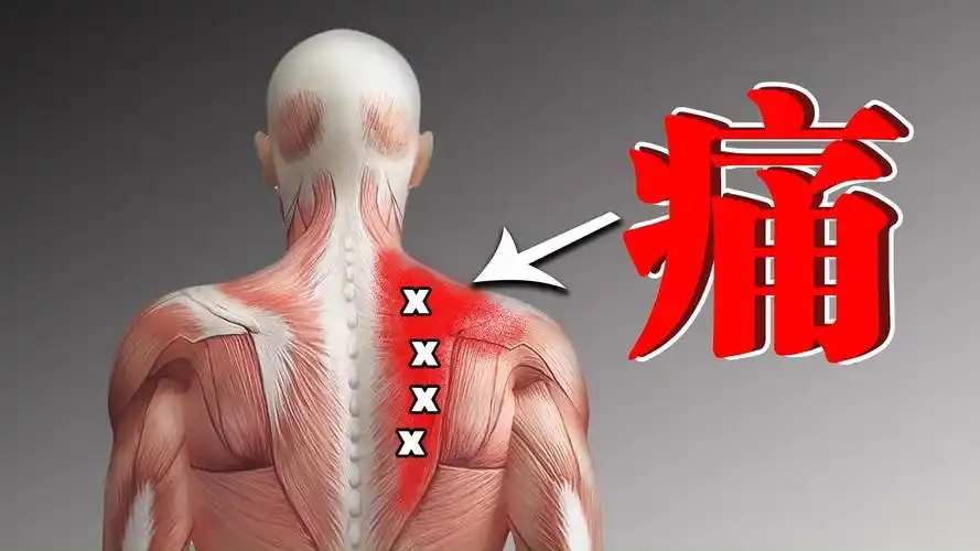 睡醒后肩膀往下拉伸肩胛骨及锁骨中间非常疼痛有类似骨头脱开来的感觉