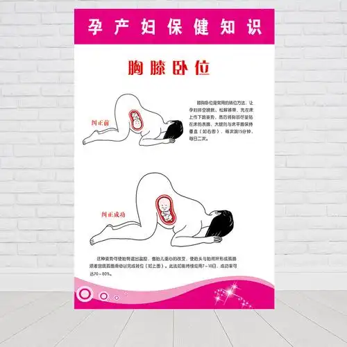 医院卫生制度文化妇产科胸膝卧位挂图走廊墙贴写真