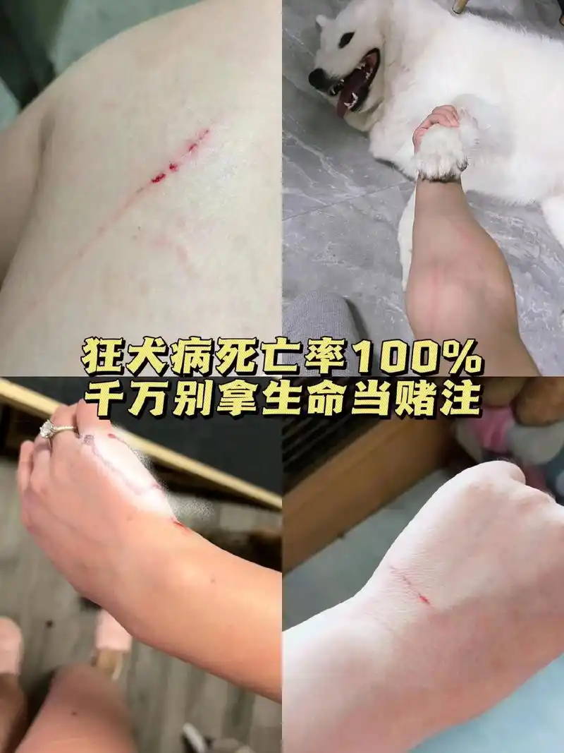 赶紧测一下吧!被猫咪狗狗抓伤一定要重 - 抖音