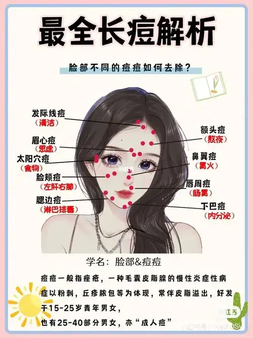 面部各个部位长痘原因