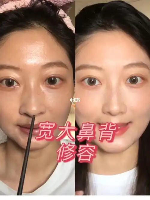 普通女孩变美小细节之宽鼻背缩窄