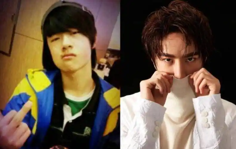 下巴脸颊凹陷,鼻子透光,分明是整容后遗症,却硬说没整过_王一博_杨紫