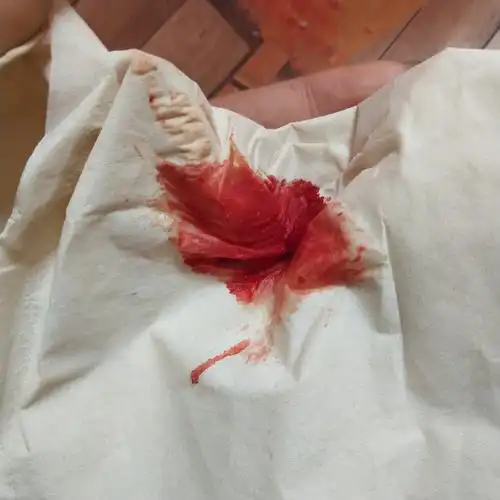 别催更新了  感冒咳出血了 .w 1月前