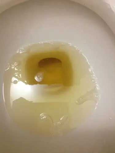 刚开始很多泡沫,10分钟后才慢慢减少的照片里的数量.