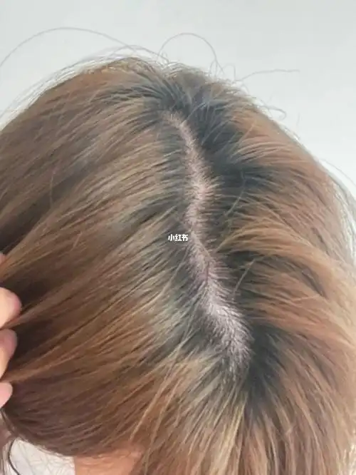 这样的发缝算正常吗