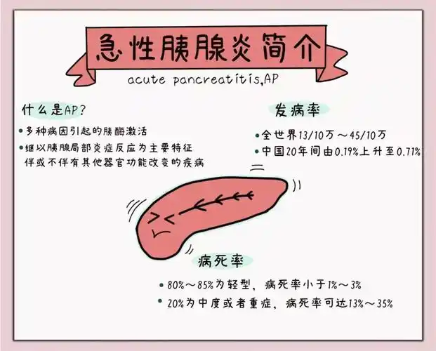 视觉夸夸营共创科普手册印刷本出炉急性胰腺炎公众与患者手册