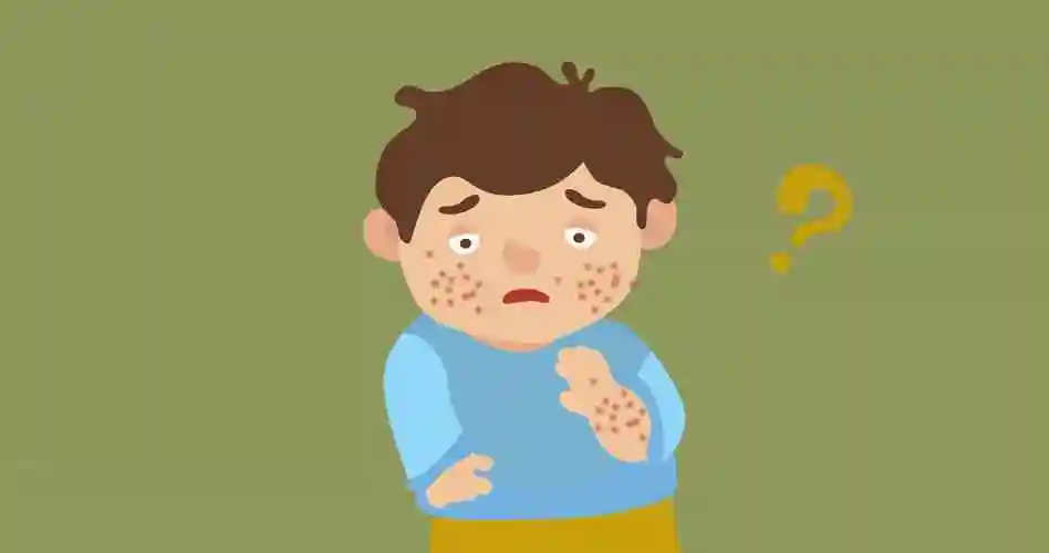 芒果易引起人体过敏