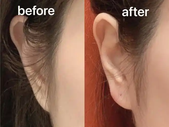 丰耳垂分享耳垂小的姐妹都给我冲