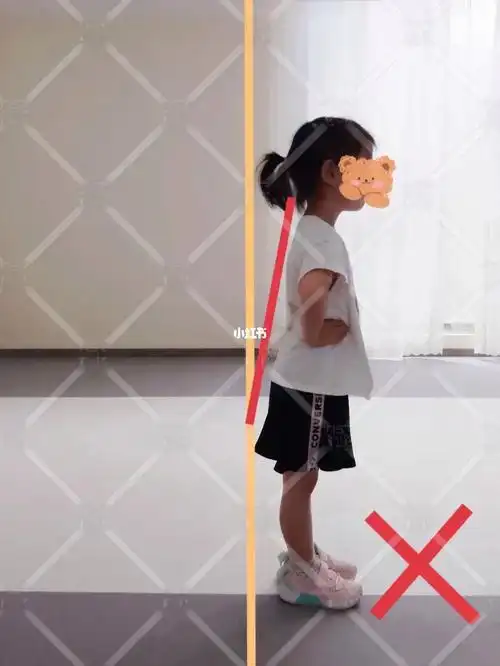 站姿纠正!体态纠正!