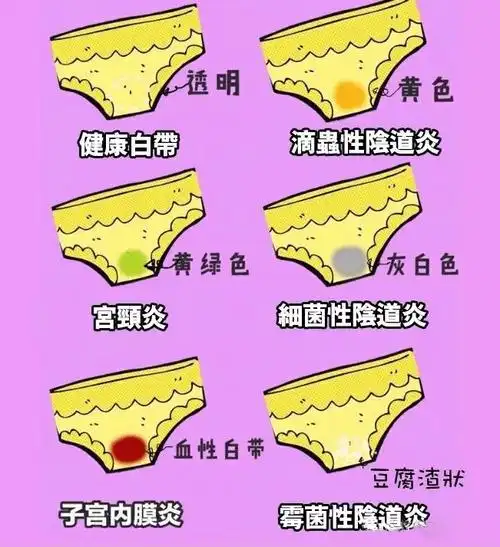 华克维两性霉素b阴道泡腾片 | 霉菌性阴炎反复发作怎么办?